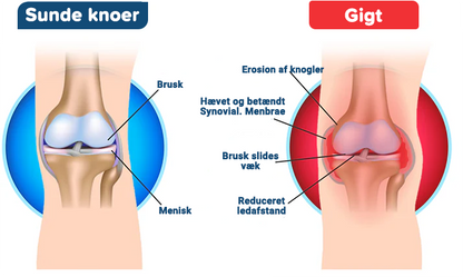 Bi Gift Avanceret led- og knogleterapicreme