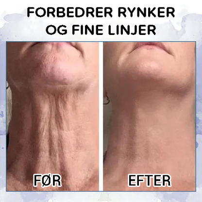 Avanceret opstrammende og rynke-reducerende creme (gendan hudens elasticitet)