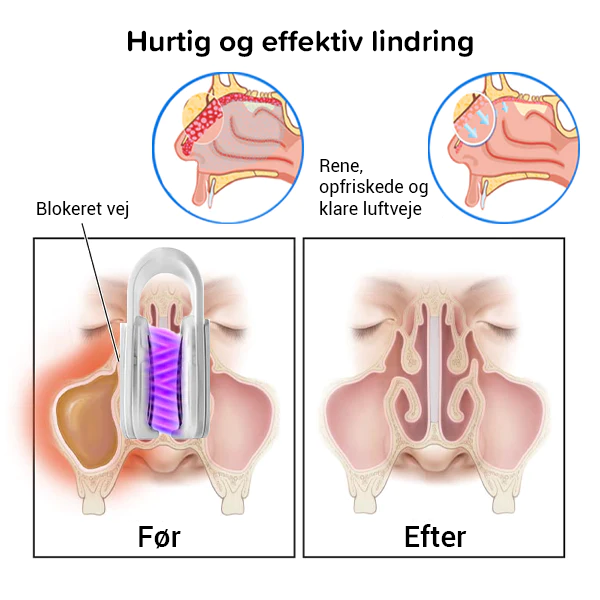 Ånde godt Renseanordning for næseslim