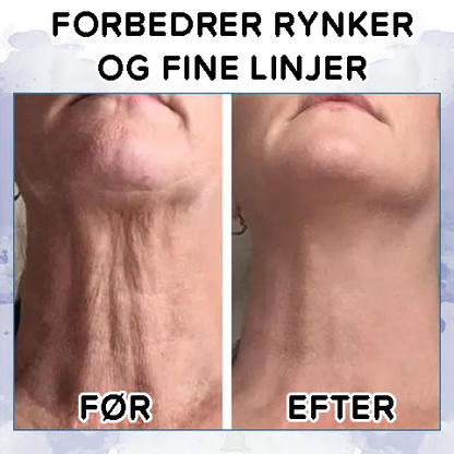 Avanceret opstrammende og rynke-reducerende creme